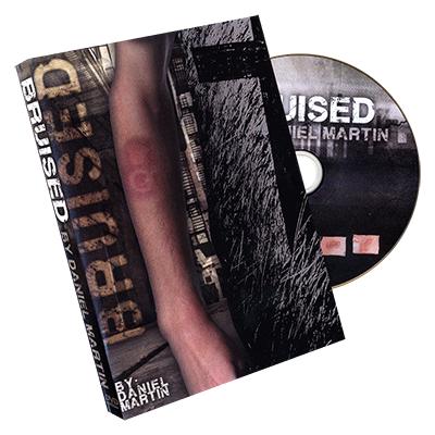 (image for) Bruised - Click Image to Close
